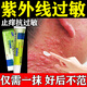 紫外線過敏專用藥膏 日光性皮炎專用特正效藥日曬性陽光性光敏性藥膏曬傷修復(fù)專用藥膏復(fù)方倍氯米松樟腦乳膏 1盒【紫外線過敏專用藥膏】早用早好