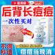 后背痘痘藥膏毛囊炎沐浴露前胸背部長(cháng)痘痘瘙癢膿包痤瘡祛痘噴霧劑 紅色