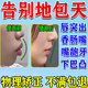 巴貝奇  BABBAGE地包天牙齒矯正器兒童6-12歲糾正小孩防咬下嘴唇矯正神器牙套yh 【低配成人款】硬度偏軟可使用1-2個(gè)月