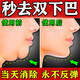 千草本原雙下巴消除神器瘦臉?biāo)幨莶弊訙p下巴提拉緊致改善贅肉溶脂消除膏 1盒【一抹消除】