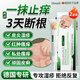 HIEUAILR德國品牌濕疹膏皮膚瘙癢皮炎皮癬真菌感染止癢100%去根專(zhuān)用非藥膏 【濕疹全身癢 反復發(fā)作】?jì)珊醒b