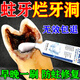 防蛀牙膏蛀牙洞復(fù)修齲齒殺蟲牙蛀牙爛牙專用的藥兒童黑線清理牙膏 1瓶裝【蛀牙修復(fù)】