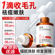 透真杏仁酸精華液收縮毛孔粗大修復(fù)細(xì)致果酸水楊酸祛痘淡痘印痘坑修護(hù)
