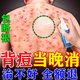 同仁堂后背痘痘藥膏淡化痘印痘坑治毛囊炎前胸后背膿包痤瘡祛痘專用噴霧 一盒裝【多買多送】發(fā)貨特效快