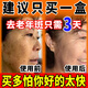 巖井昃弘去斑專用醫(yī)用正品祛斑霜美白淡化黃褐雀斑黑色素老年點(diǎn)斑藥一夜消 3盒特效【醫(yī)美熱銷】99w患者去除 美白祛斑霜