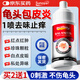 Sunoyar龜頭炎包皮炎噴劑真菌感染念珠菌男性專用護理液瘙癢異味紅腫