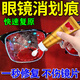 眼睛鏡片劃痕修復液近視眼鏡磨損樹(shù)脂玻璃刮痕修復清潔液拋光神器 送海綿和毛巾【一支裝】劃痕克星