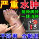 北京同仁堂消水腫下肢浮腫腿腫消腫專用膏藥老年人利尿四肢腳面消水腫腫脹貼1盒體驗(yàn)裝（發(fā)貨特效快）