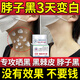 花月情脖子黑色素去除沉淀黑棘皮病治脖子黑色素藥膏祛胳膊肘腋下黑克星 買2送1【發(fā)三盒】一抹變白