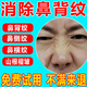 鼻背紋去除神器久消除修復臉上鼻梁橫紋貼抗皺紋防衰老祛額頭肌肉臉川字紋淡化山根褶皺緊致舒紋面霜 單盒體驗裝