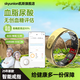 Skyunion【智能戒指】高精度尿酸血脂多功能穿戴無(wú)創(chuàng)血糖評(píng)估血壓睡眠血氧心率指環(huán)智能戒指運(yùn)動(dòng)計(jì)步新戒指 【金色】L01血脂四項(xiàng)戒指 8號(hào)（體重建議55kg-60kg）
