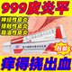 999皮炎平皮膚瘙癢止癢皮炎濕疹復(fù)方醋酸地塞米松乳膏軟膏糠酸莫米米松老牌子真菌感染成人兒童三九皮炎 1盒裝【1O克恒.健.復(fù)方醋酸地塞米松乳膏】