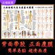 【人體十二經(jīng)絡(luò)圖解】人體病癥穴位海報(bào)中醫(yī)掛圖全身新款自粘墻貼 白色款-人體病癥對照--十二經(jīng)絡(luò) 相紙(背面無膠)表面覆膜高120
