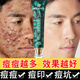 同仁堂祛痘藥膏去痘痘和痘印修復(fù)淡化痘印痘坑男女士青春痘閉口粉刺痤瘡 1瓶【體驗裝】