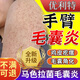 優(yōu)立特手臂毛囊炎專用噴霧劑胳膊上長小疙瘩小紅點雞皮膚毛周囊角化癥BC 2盒【優(yōu)惠裝】第二盒半價