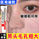 阿達(dá)帕林醫(yī)用凝膠祛痘消炎痤瘡專用改善毛孔粗大收縮毛孔去黑頭修復(fù)細(xì)致水楊酸軟膏角質(zhì)增生皮膚暗沉干燥 1盒阿達(dá)帕林【改善毛孔粗大去黑頭醫(yī)用】