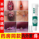 苗居堂康痔靈痔瘡膏去肉球內(nèi)痔瘡?fù)庵摊徃嗳馇蚧旌现倘ブ勿氙從z便血肛門瘙癢軟膏