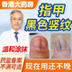 甲母痣專(zhuān)用搭藥指甲長(cháng)黑線(xiàn)阿莫羅芬搽劑修復液手指甲黑腳趾擠壓變黑凹凸不平分層脆弱精華液 單盒體驗裝