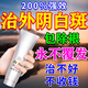 田哥外陰白斑專用的藥膏止癢去根私處萎縮瘙癢干裂婦科外陰瘙癢專用膏 特效體驗裝【一盒】專除外陰白斑 萎縮營養(yǎng)不良專用修復(fù)膏