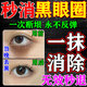 儷之康黑眼圈重度去除眼膜貼眼袋提拉緊致抗皺去除眼霜淡化細(xì)紋熬夜專用 1盒裝【重度黑眼圈修護(hù)眼貼】