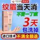 進(jìn)口洗眉毛快速淡化去紋眉紅眉毛褪色劑藥水正品院用儀機(jī)器激光脫色 [強效；單盒裝] 無痛消除