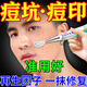 內(nèi)廷上用痘印痘坑修復(fù)凹洞生長因子填充再生醫(yī)用祛痘膏淡化痘印黑色素沉淀 一支 痘痘肌祛痘印淡化黑色素