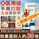 同仁堂非重度灰指甲特效專(zhuān)用膏藥指甲真菌感染非進(jìn)口灰甲凈鳳仙花抑菌液 2-5個(gè)灰甲強薦【69%人選擇】3盒
