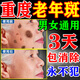香草雨露老年斑臉部手背祛斑專(zhuān)用霜去老人斑的膏藥祛除美白淡化黑色素軟膏 買(mǎi)3贈2【虧本售賣(mài)】沒(méi)有差評 專(zhuān)用特效非一夜消日本進(jìn)口