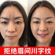 韓倫美羽（HUNMUI）水滴川字紋貼膜抬頭紋法令紋貼淡化眉間紋懸針紋額頭紋貼提拉緊致 川字紋貼1盒（0.6g*24貼）