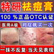 祛痘痘藥膏學(xué)生青春痘甲硝酸銼凝膠甲硝唑凝膠祛痘消炎痤瘡專用藥青少年去痘痘修復(fù)消炎和淡化痘印黑色素沉淀 1盒【臉上長(zhǎng)痘痘專用藥膏】100%發(fā)貨特效快 國(guó)藥準(zhǔn)字OTC藥房直發(fā)
