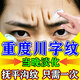 澳福來川字紋貼去除神器抬頭紋男重度去除紋皺紋專用法令紋懸紋睡覺填充 一盒裝【德國進口】