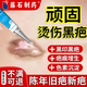 燒燙傷疤痕配合其他修復產(chǎn)品去色素除疤膏凝膠去疤痕專(zhuān)用開(kāi)水油燙傷去疤膏燒傷油去黑印油點(diǎn)醫用兒童O6 二盒 送棉簽【輕度燒燙傷印記適用】