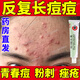 維A酸乳膏 祛痘藥膏 祛痘印修復淡化痘印痘坑修復藥膏醫(yī)用 祛痘消炎痤瘡專用 青春痘祛痘i膏學生去痘痘 1盒【國藥OTC 藥房直發(fā)】