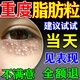 脂肪粒去除藥膏神器眼部專用眼霜消除汗管瘤脂肪油脂粒粟丘疹克星 特效:一盒裝