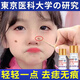 點痣藥水祛痣膏祛斑無痕臉部痦子黑點去斑點斑去痣神器雀斑不留疤 一盒【輕微小黑點】體驗裝