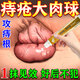 痔瘡凝膠100%專(zhuān)用根i斷正品痔瘡膏快速止i血止i痛消腫脫肉球 【重度100%特效】1盒 痔瘡膏肉球痔瘡專(zhuān)用特效