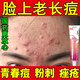 祛痘藥膏消炎痤瘡專(zhuān)用青少年淡化痘印痘坑修復藥膏醫用青春痘祛痘i膏學(xué)生去痘痘痤瘡專(zhuān)用 維A酸乳膏 1盒【國藥準字 祛痘好藥】