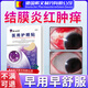 DR.AVIN過(guò)敏性結膜炎用眼貼冰敷眼罩暴露性角膜炎神器醫用冷敷貼眼膜BD 二盒【第2盒半價(jià)】