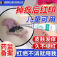 藤石制藥摔傷擦傷疤痕結(jié)痂脫落去紅印修復(fù)去疤去色素祛疤專用凝膠臉部膏CB 單盒裝 去黑印紅印黑色素沉淀藥房同售
