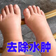 鄒潤安水腫消腫浮腫下肢水腫藥消除利臉腫四肢腫老人腳腫全身浮腫去腫濕 單盒裝【體驗裝】
