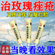 仁和祛痘消炎痤瘡專(zhuān)用青少年酒糟鼻閉口玫瑰痤瘡專(zhuān)用藥膏臉上長(cháng)粉刺毛孔堵塞痤瘡痘印硬疙瘩膿包消炎新膚螨靈軟膏 1盒【仁和大品牌 殺螨止癢】