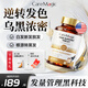 CareMagic復(fù)合維生素烏黑秀發(fā)養(yǎng)根黑發(fā)片2.0變白頭發(fā)變黑治根b6葉酸內(nèi)調(diào) 【拍3瓶送提高免疫VC】1瓶裝