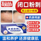 閉口粉刺克星逆光疹臉上起小疙瘩肉色丘疹軟膏祛額頭痘痘痤瘡特藥 特效閉口粉刺克星額頭祛痘膏丘疹