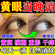 黃斑病變眼藥水眼白清澈去黃滴眼液視神經(jīng)萎縮眼睛發(fā)黃紅血絲干黃斑病變?nèi)~黃素專用 1盒【體驗(yàn)裝】