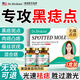 DR.BROKINS點痣膏水疤痕修復臉部去痣官方正品不留疤點斑疣雀斑去黑痣點疣水 三盒裝【2~6顆黑痣、疣、斑】