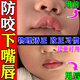 巴貝奇  BABBAGE防咬下嘴唇矯正神器牙套寶寶嬰兒童吃手嘴凸磨牙口呼吸下巴后縮貼 兒童普通款【硬度偏軟】矯正慢