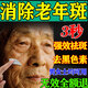 老年斑專用的i藥一夜消強(qiáng)力去除老人斑臉部黑色素手背正品祛斑霜 20g /一盒裝【快速祛斑】