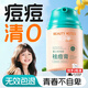 BEAUTY NOTES青少年祛痘膏面霜學(xué)生護膚品12-18歲青春痘淡化痘痘印圣誕節禮物