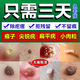 維a酸乳膏去疣醫(yī)用去疣膏去疣專用藥疣瘊靈去除脖子小肉粒扁平疣特進(jìn)口效藥絲狀疣脖子頸部專用藥 皮膚用藥 1盒【去疣專用藥】