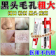 阿達(dá)帕林凝膠去黑頭改善毛孔粗大醫(yī)用正品修復(fù)細(xì)致鼻子祛黑頭收縮毛孔粉刺祛痘消炎痤瘡男士女專用旗艦店官方 1盒【輕微黑頭】皮膚用藥